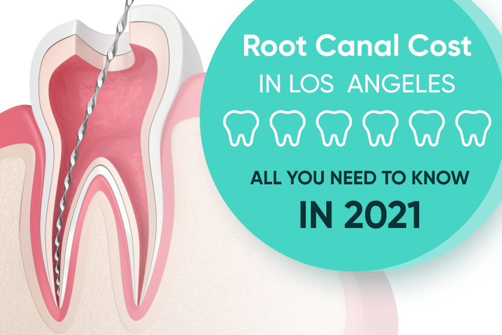 root canal cost in Los Angeles
