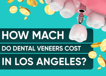How Much Do Dental Implants Cost  in Los Angeles