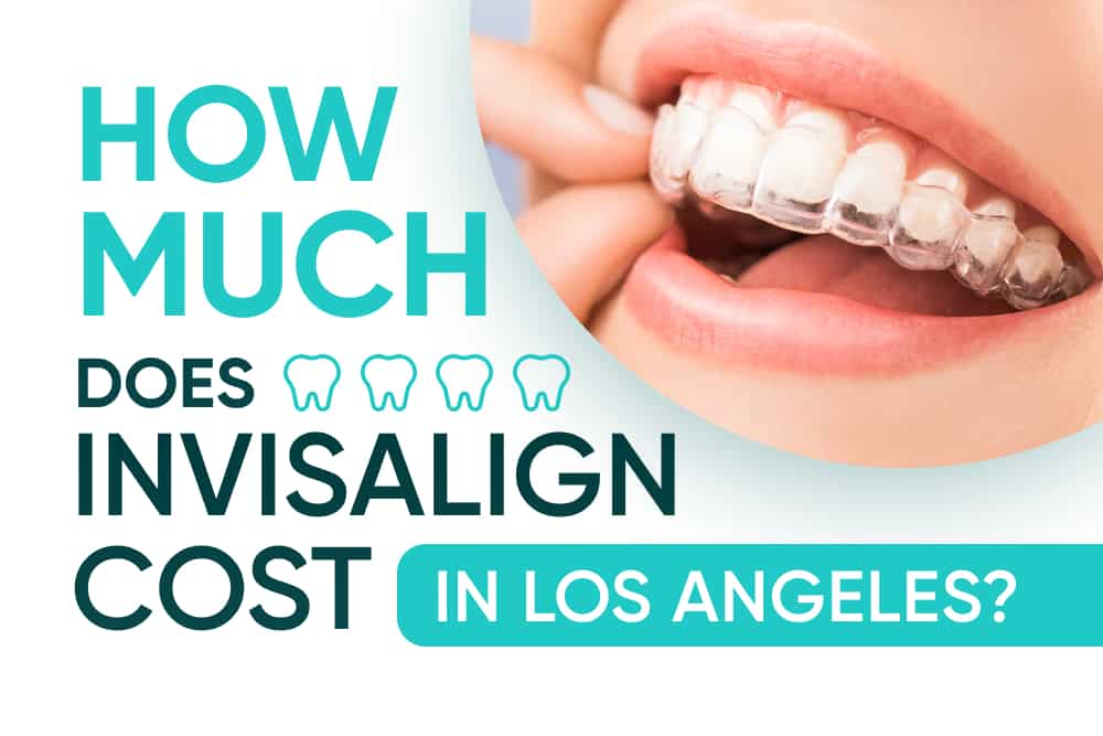 how much does invisalign cost in los angeles