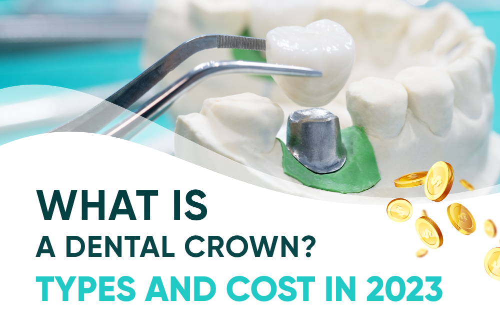 What is a Dental Crown? Types and Cost in 2023