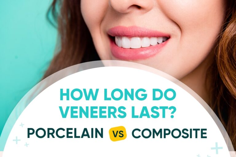 How long do porcelain veneers last? NoHo Family Dental