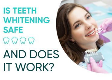 Is Teeth Whitening Safe, and Does It Work?