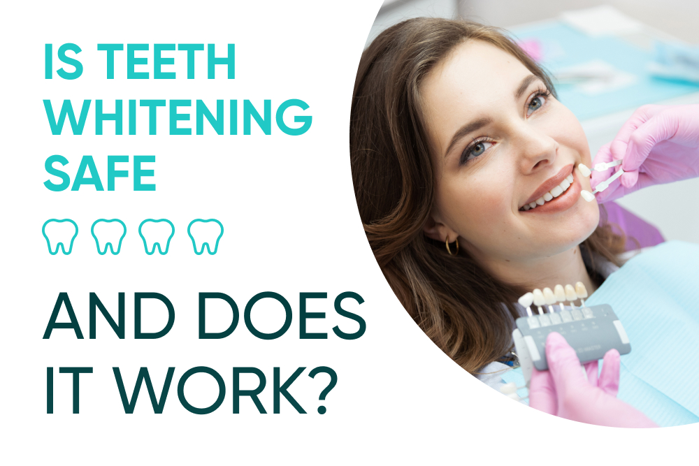 Is Teeth Whitening Safe, and Does It Work_